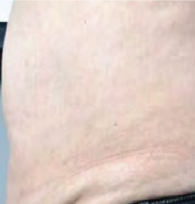 Contour3