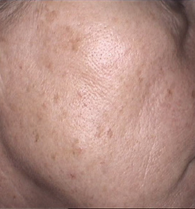 face-before